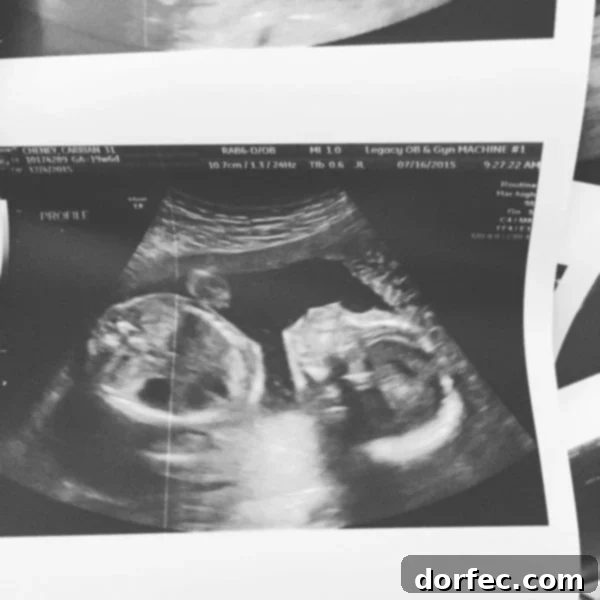 A photo of an ultrasound of a baby showing a developing heart.