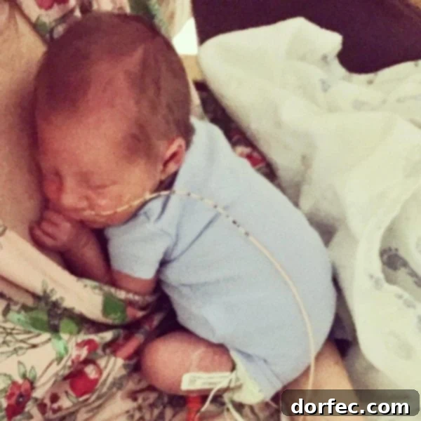 A tender photo of our little preemie baby curled up on my chest, skin-to-skin.