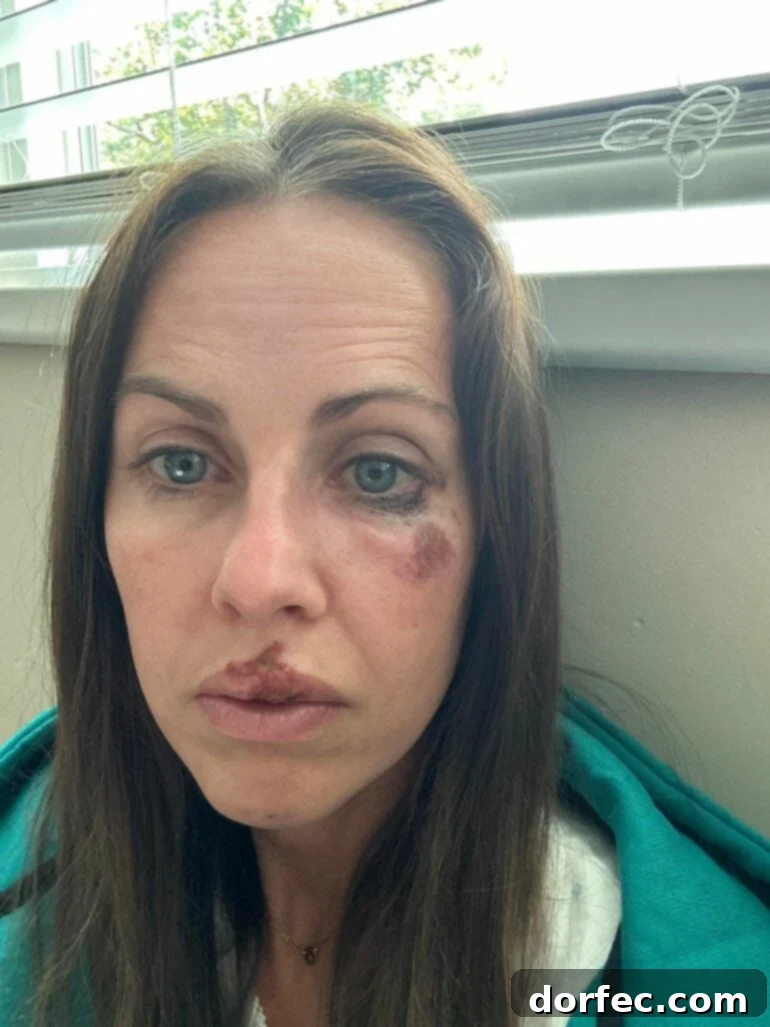 The aftermath of a bike accident, showing a helmet near the scene.